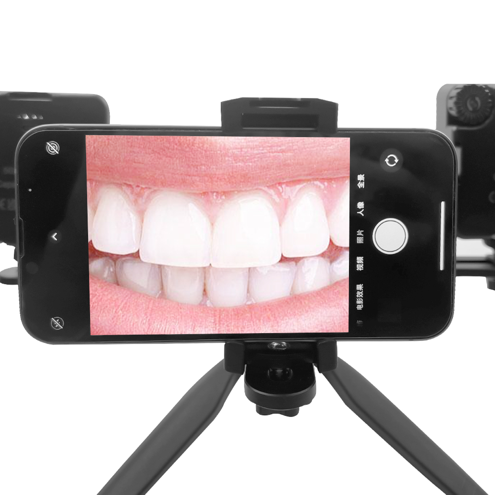 Dental Photography Light Intra - đánh giá và giá Photography Mobile Lighting